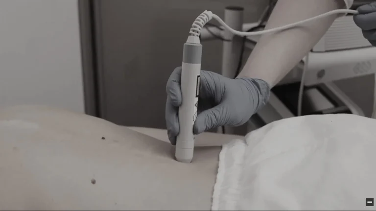 ultrazvucna terapija - Celulit Ekspert - Lider u estetskoj i fizikalnoj terapiji