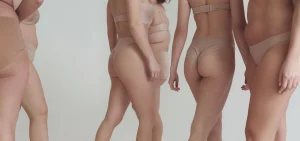 vrste celulita celulit